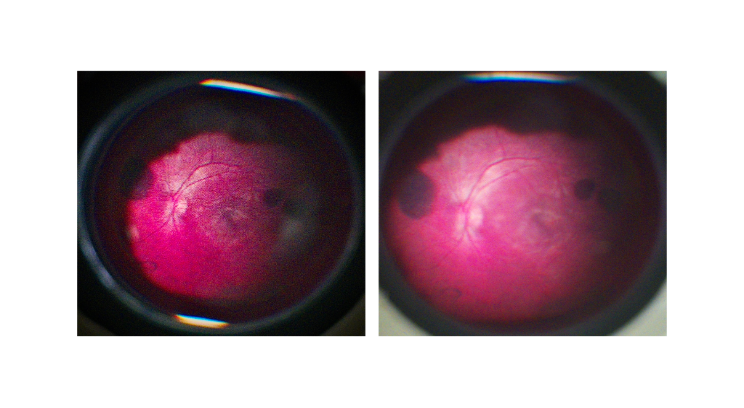 Retinal images captured with the Retinex prototype during early-stage imaging tests.