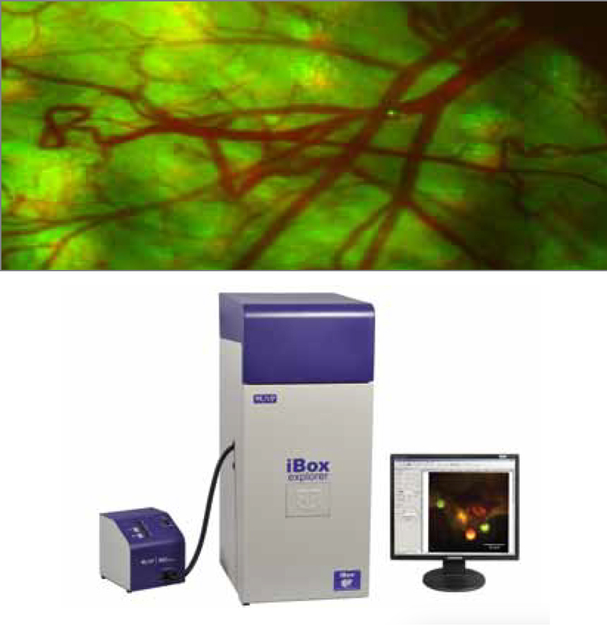 UVP社のiBox<sup>®</sup> Explorer™ 生体内イメージャーを用いて画像化したマウスの血管系内の癌細胞の細胞輸送。この画像化装置は、既製のアクロマティックレンズやシングレットレンズ、及びフィルターを用いてレンズ複数枚構成の対物レンズや結像レンズを作り、それぞれの組み合わせにより7種類の異なる倍率を提供することができる。フィルターの組み合わせは、各カラーチャネルで良好なSN比が得られるように最適化された。人間のHT-1080線維肉腫細胞のGFPタグ化核は、注射部位から下流側に移動し、遠位静脈の分岐を通過するのが確認できる (中央下と右側）。